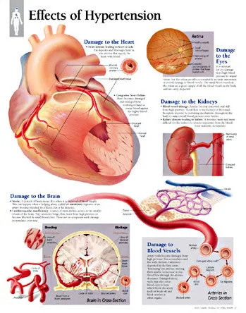 2451-08 Effects of Hypertension