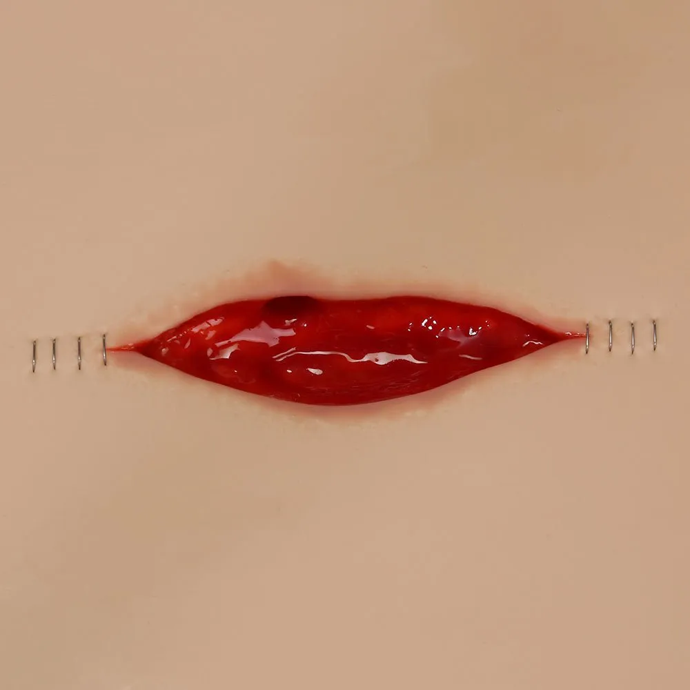 Dehisced Wound Board, Light Skin