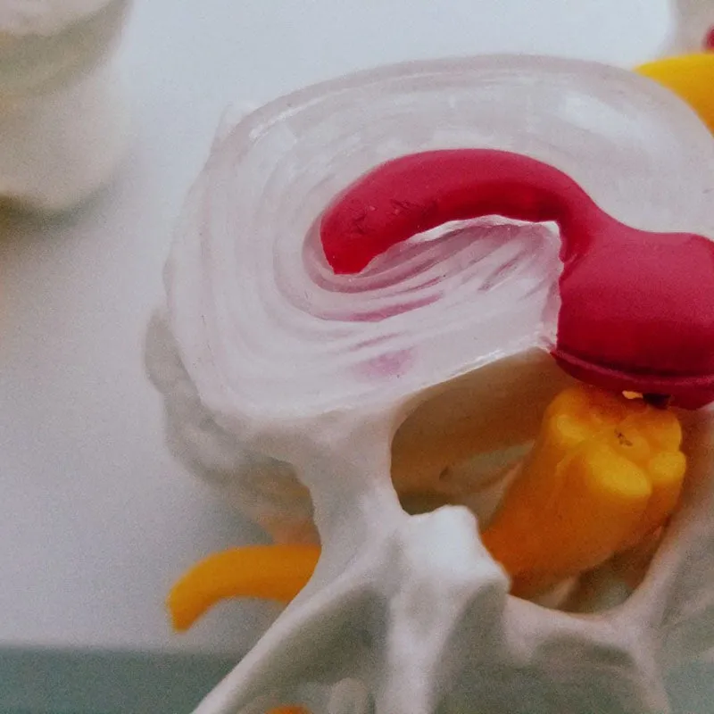 Human Anatomy Skeleton Spine 4-Stages Lumbar Vertebral Model Brain Skull Traumatic Medical Teaching Supplies