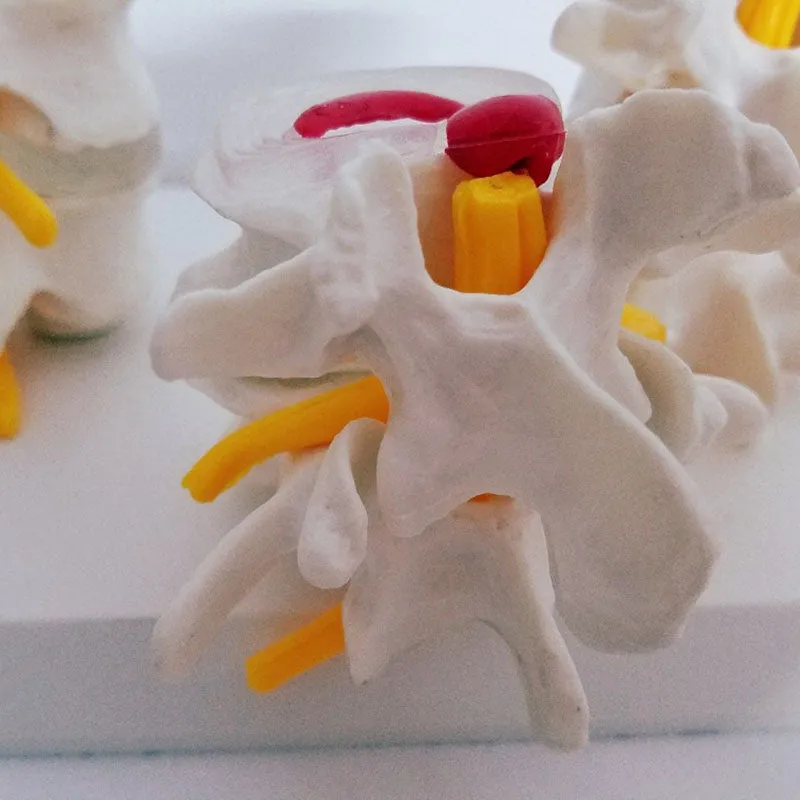 Human Anatomy Skeleton Spine 4-Stages Lumbar Vertebral Model Brain Skull Traumatic Medical Teaching Supplies
