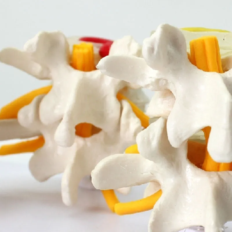 Human Anatomy Skeleton Spine 4-Stages Lumbar Vertebral Model Brain Skull Traumatic Medical Teaching Supplies
