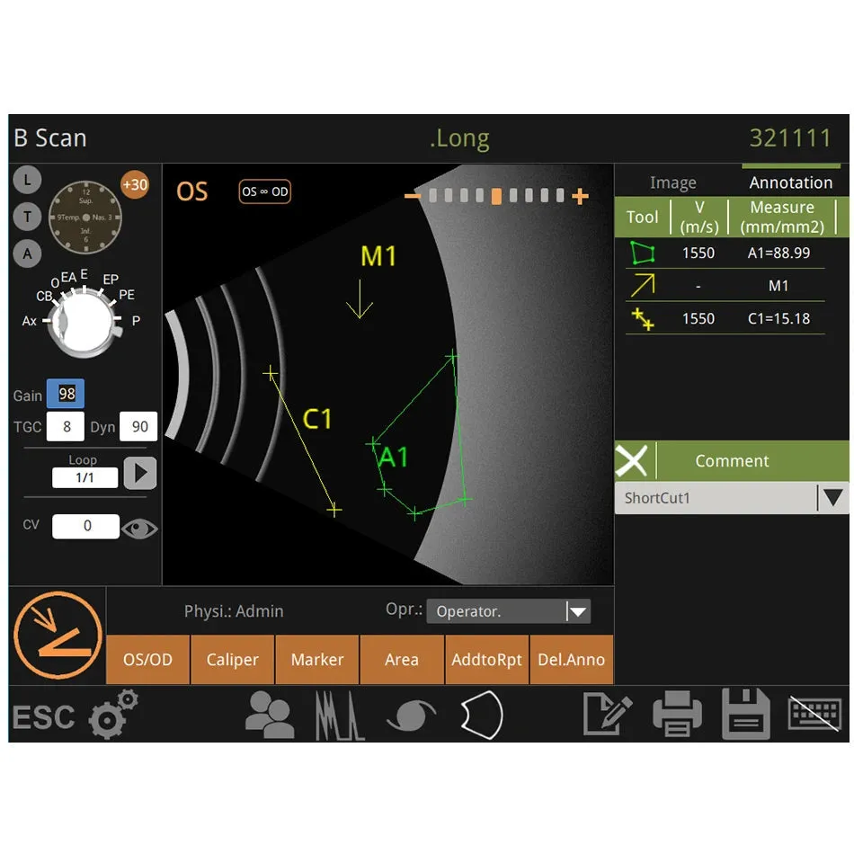 Portable Ophthalmic Ultrasound A/B Scan Medical machine for biometry eye test I ophthalmology I Model Retiwave1000