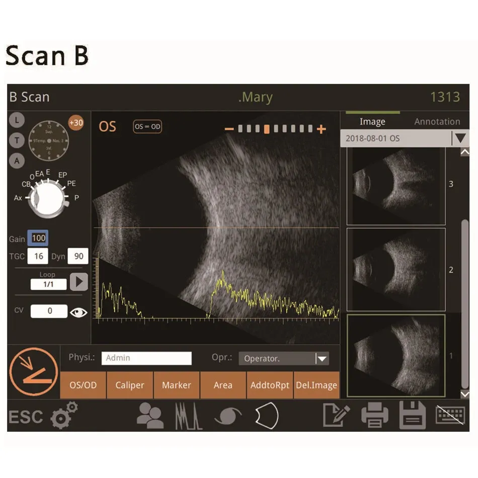 Portable Ophthalmic Ultrasound A/B Scan Medical machine for biometry eye test I ophthalmology I Model Retiwave1000