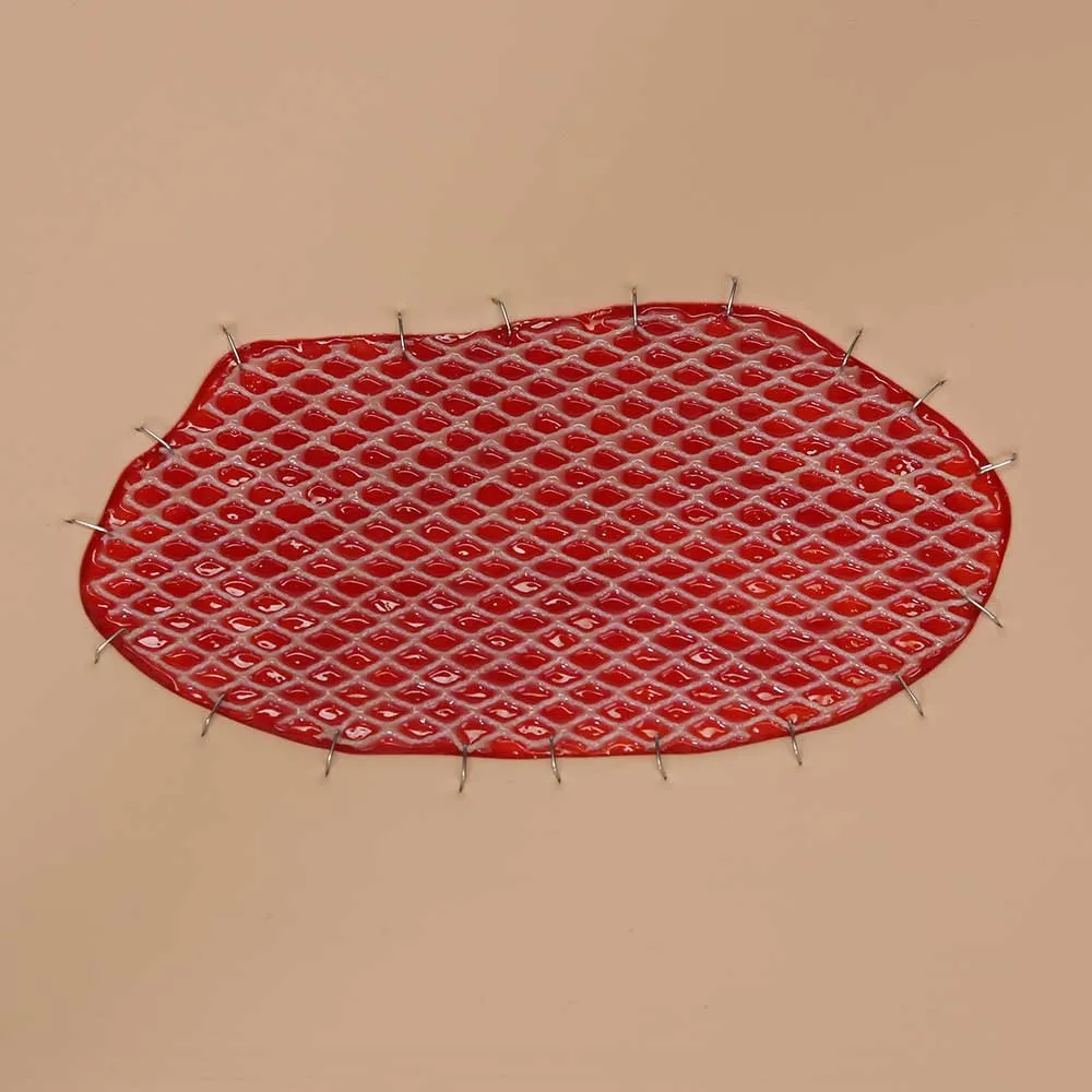 Skin Graft Wound Board, Light Skin