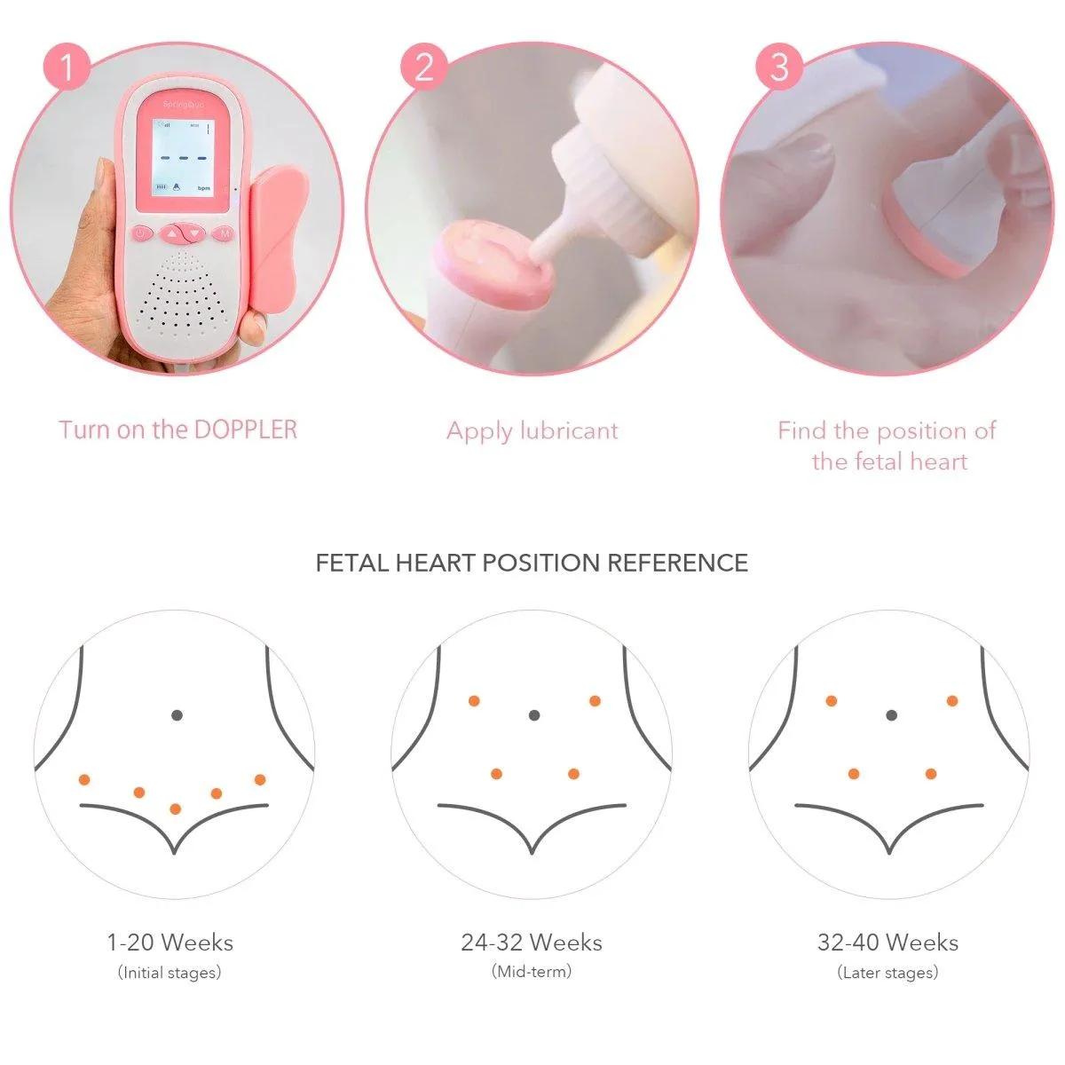 SpringBud FD-500B Fetal Doppler with 60g Ultrasound Gel FDA Cleared